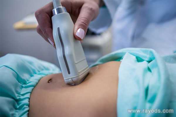 泰国曼谷BIC中心哪个医生做羊角子宫怀孕成功率高？